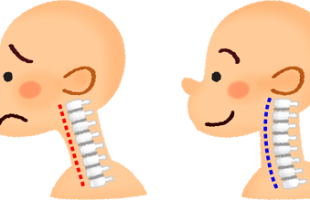 straight-neck
