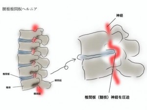 13d997dd460a353a963cf02b4f963661_t