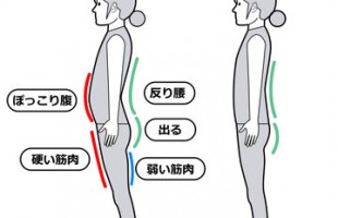 反り腰画像