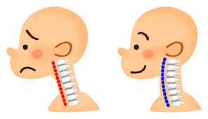 ストレートネック2